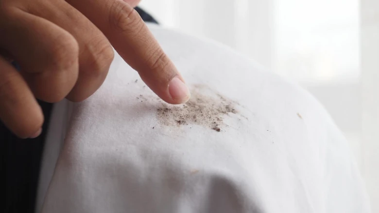 10 Cara Menghilangkan Jamur di Baju yang Mudah, Wajib Coba!