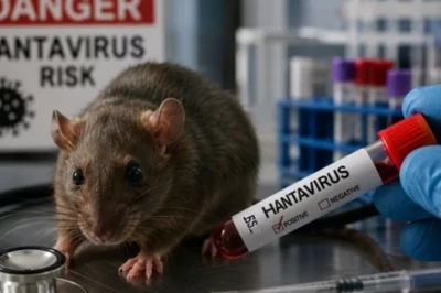 Hantavirus Bisa Sebabkan Gagal Ginjal, Dinkes Jateng Ingatkan Gejala Awal